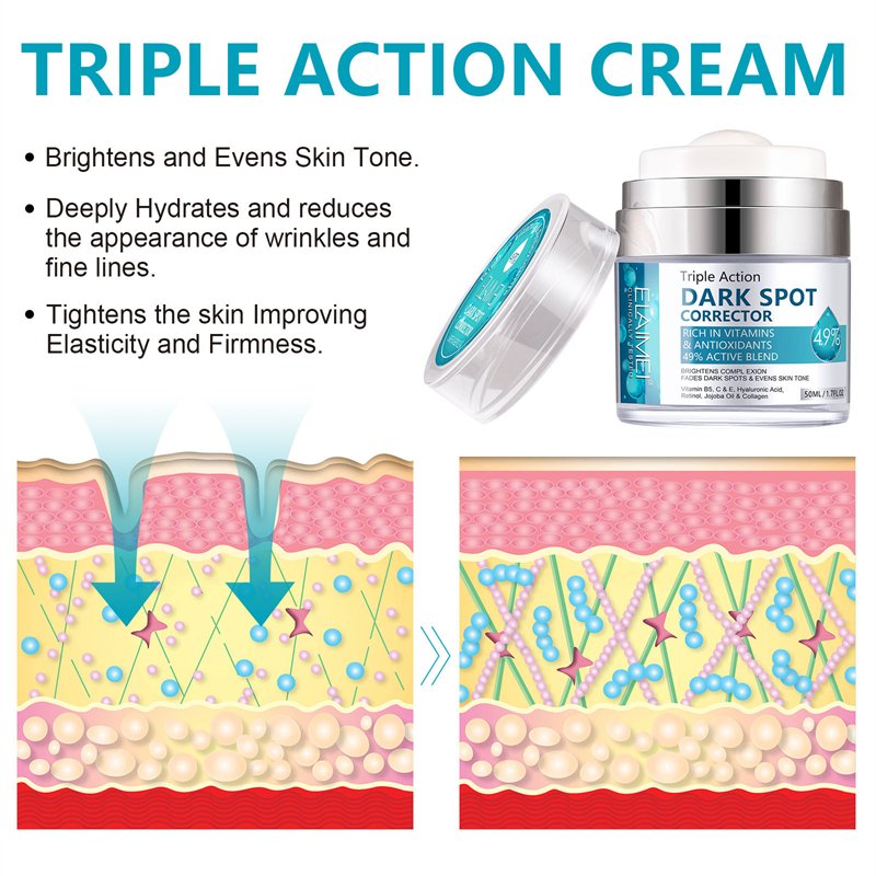face skin care dark spot corrector remover face cream anti wrinkle moisturizing remove melasma whitening anti freckle cream