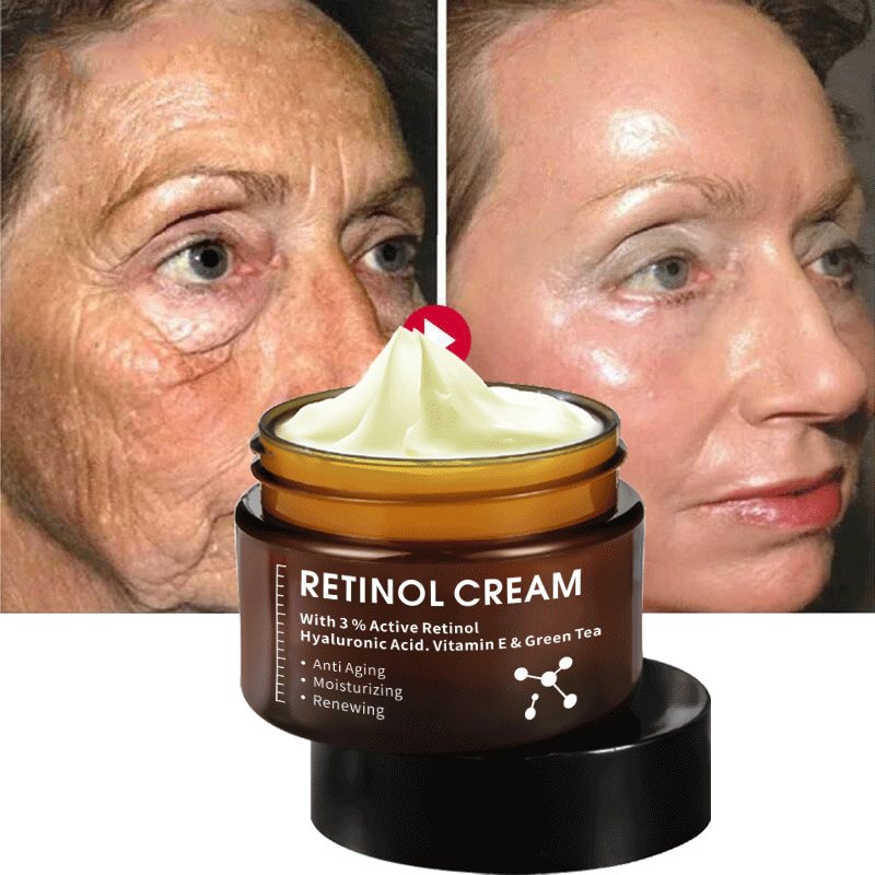 private label Natural organic 3% retinol moisturizer whitening anti aging repairing face cream