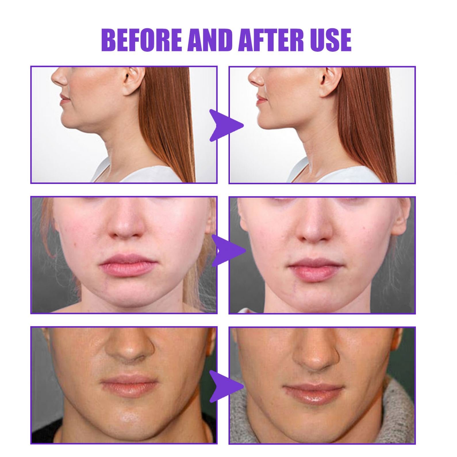 Jaysuing Firming Micro-face Cream Anti Aging Whitening Moisturizing Lifting Firming tightening Slimming V Line Shape Face Cream