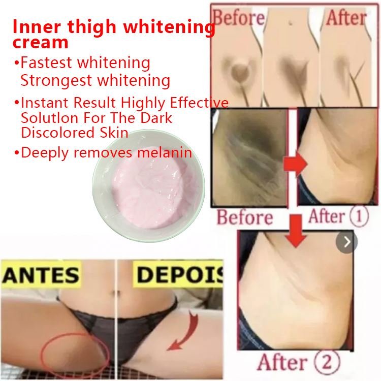 Give Formulas In Vietnam White Body Hydrating Face Dark Spot Removing Acne Facial Turmeric Skin Whitening Cream