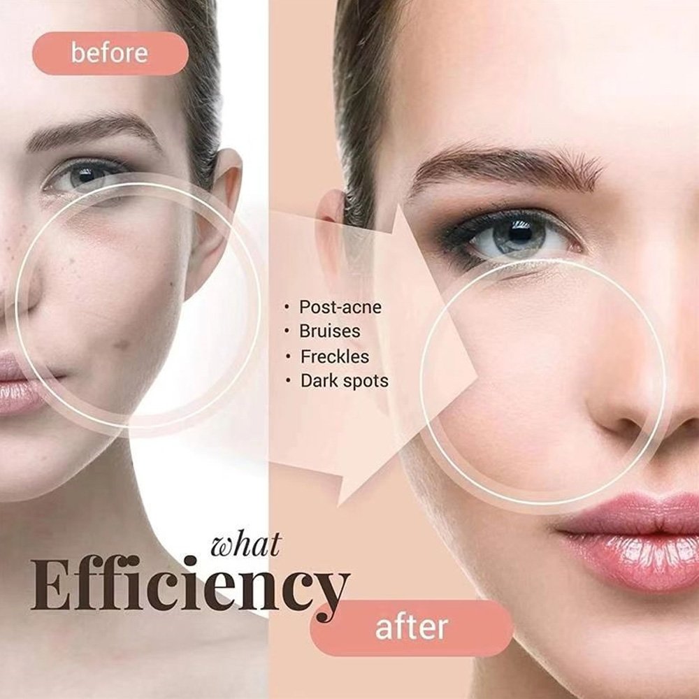 SPA Star Product Skin Whitening Face Cream for Pigmentation Dark Spots Age Spot Removing Face Whitening Cream Day and Night Use