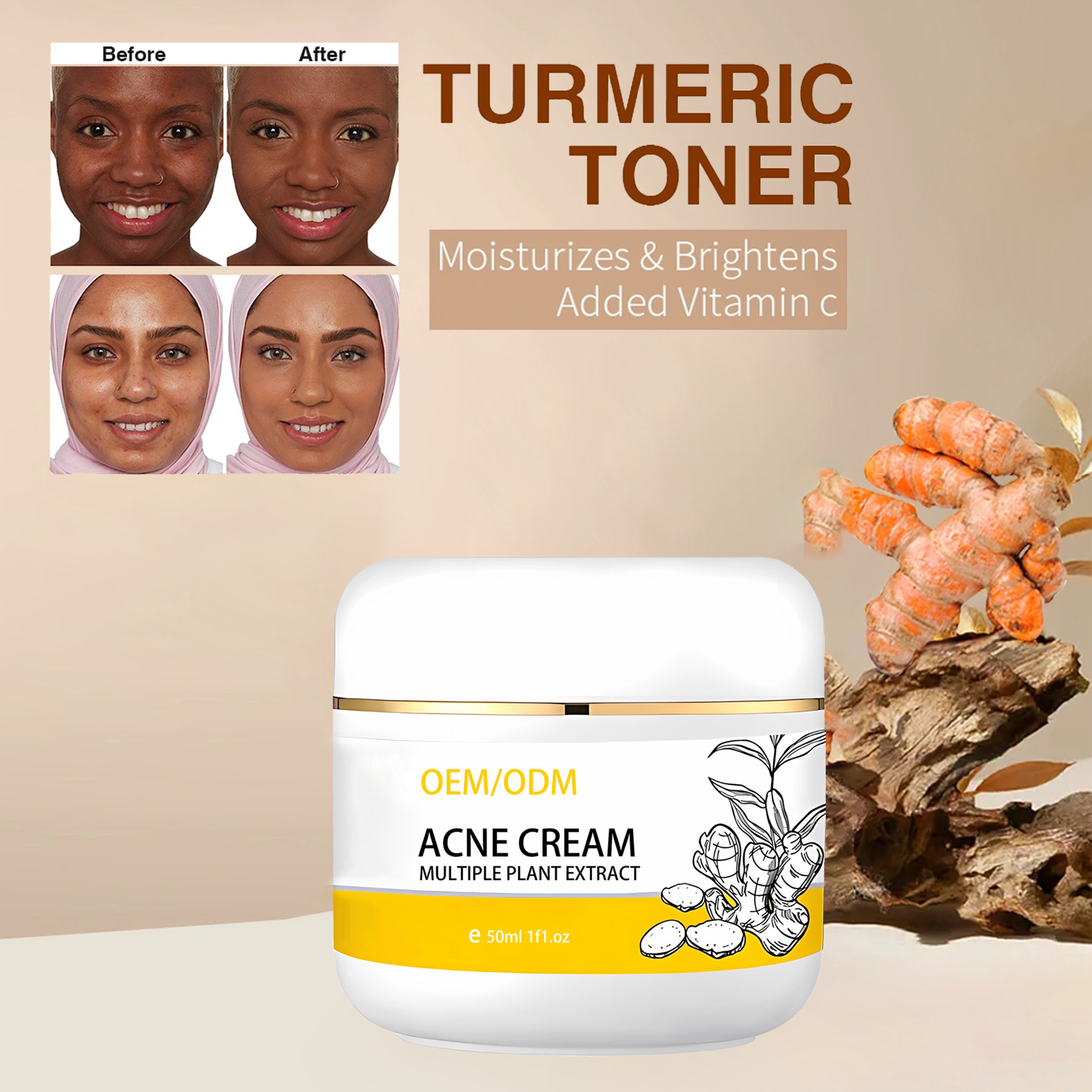 Private label turmeric face cream Facial whitening And Acne Removal Pimple Face Anti Acne Cream best face cream for fair skin