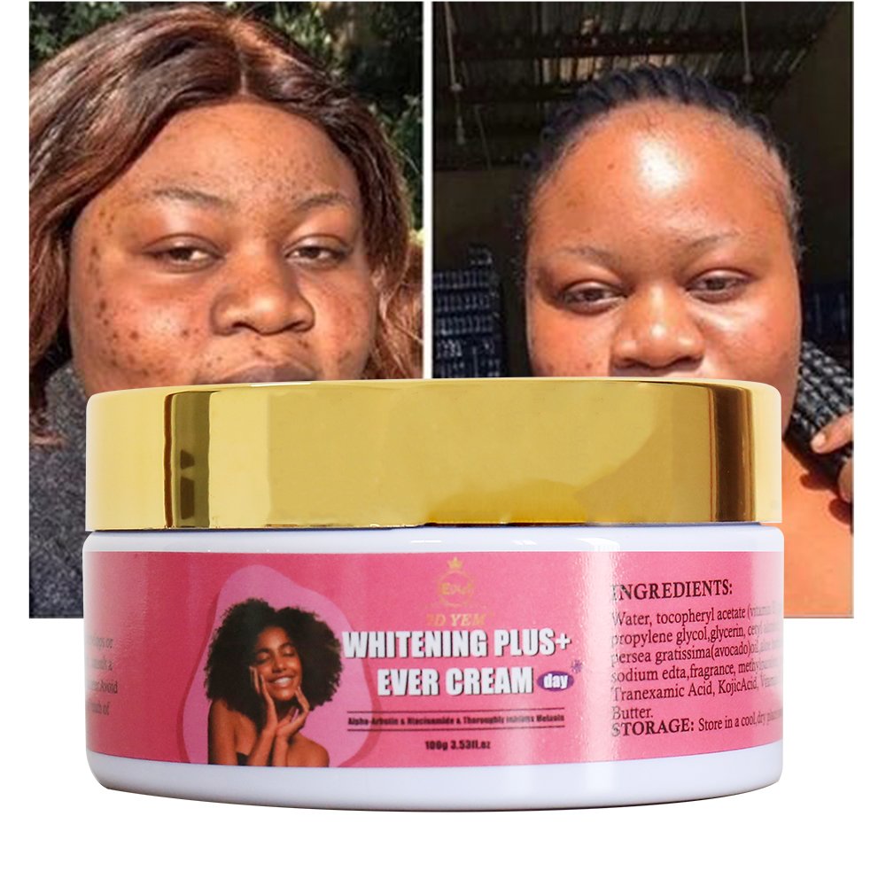 Hot selling product Brightening cream removing black spots acne moisturizing skin whitening creams without side effects
