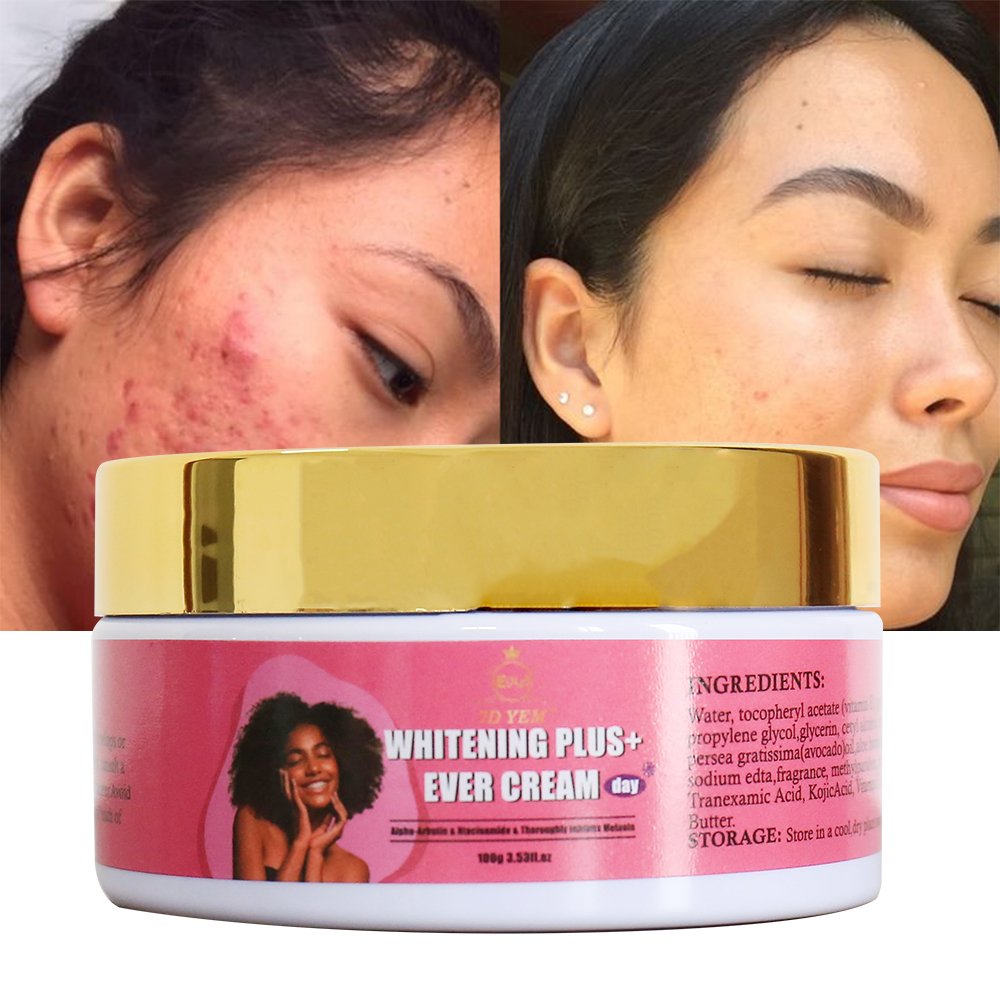 Hot selling product Brightening cream removing black spots acne moisturizing skin whitening creams without side effects