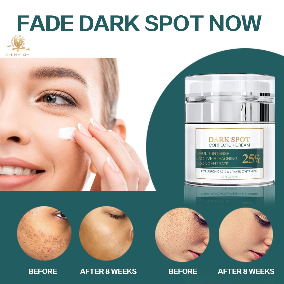 Anti Pigmentation Aging Brightening Lightening Whitening Melasma Removal Dark Spot Remover Corrector Face Cream For Dark Skin