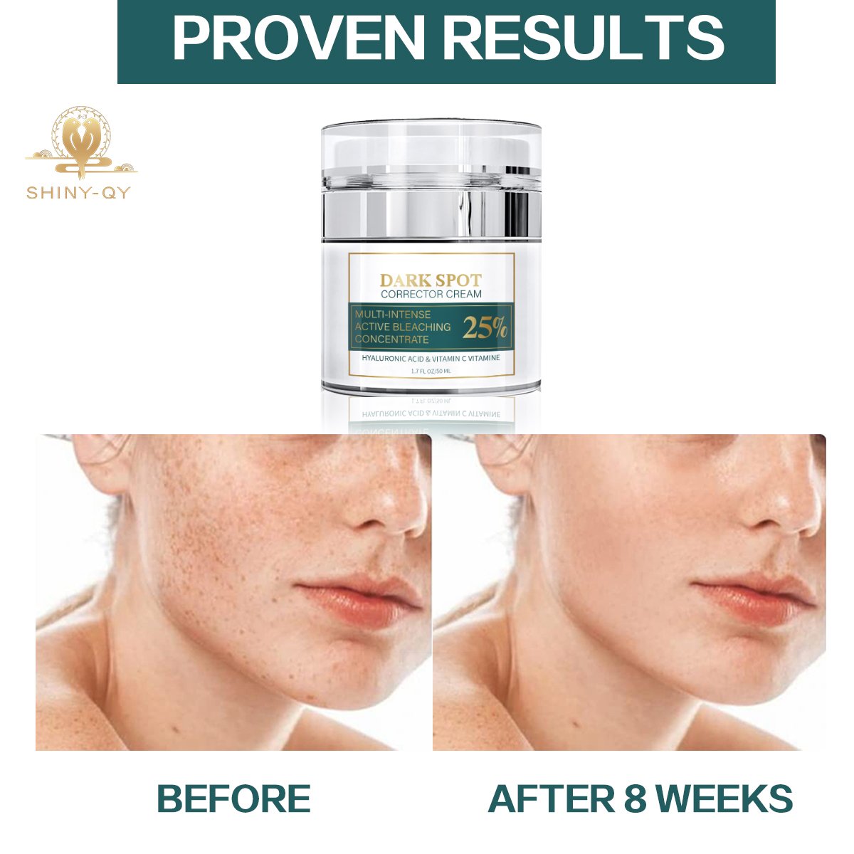 Anti Pigmentation Aging Brightening Lightening Whitening Melasma Removal Dark Spot Remover Corrector Face Cream For Dark Skin