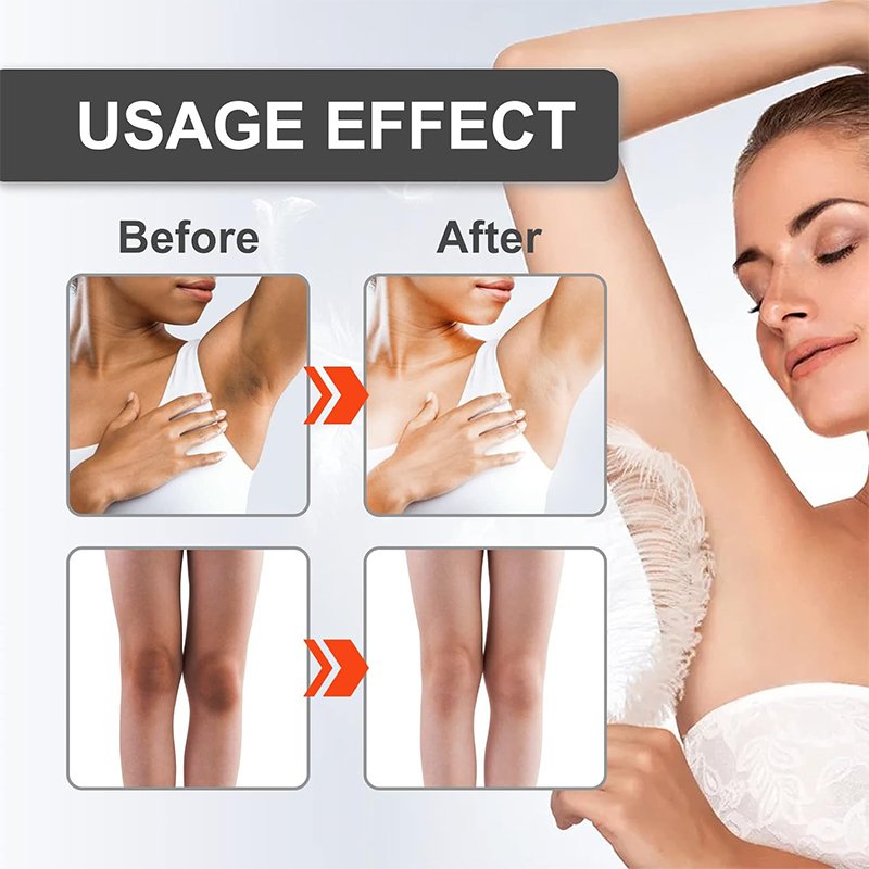 Free Sample Anti Freckle Whitening Deep Moisturizing Removal Dark Spot Corrector Spot Remover Face Cream Black Day Adults XL