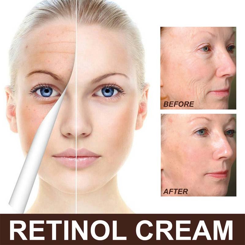 Natural Skincare Vegan Organic Anti Aging Moisturizer Cream Anti-wrinkle Hydrating Moisturizer Face Cream Retinol Cream