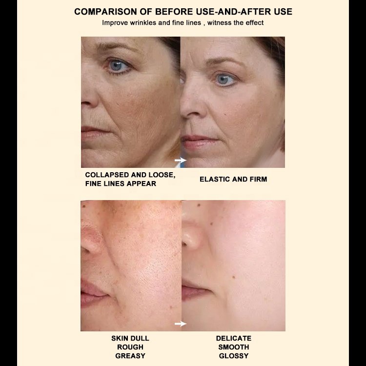 Private label stock Anti Aging Bosein anti-wrinkle skincare cream Collagen resilient multi-dimensional firming face cream