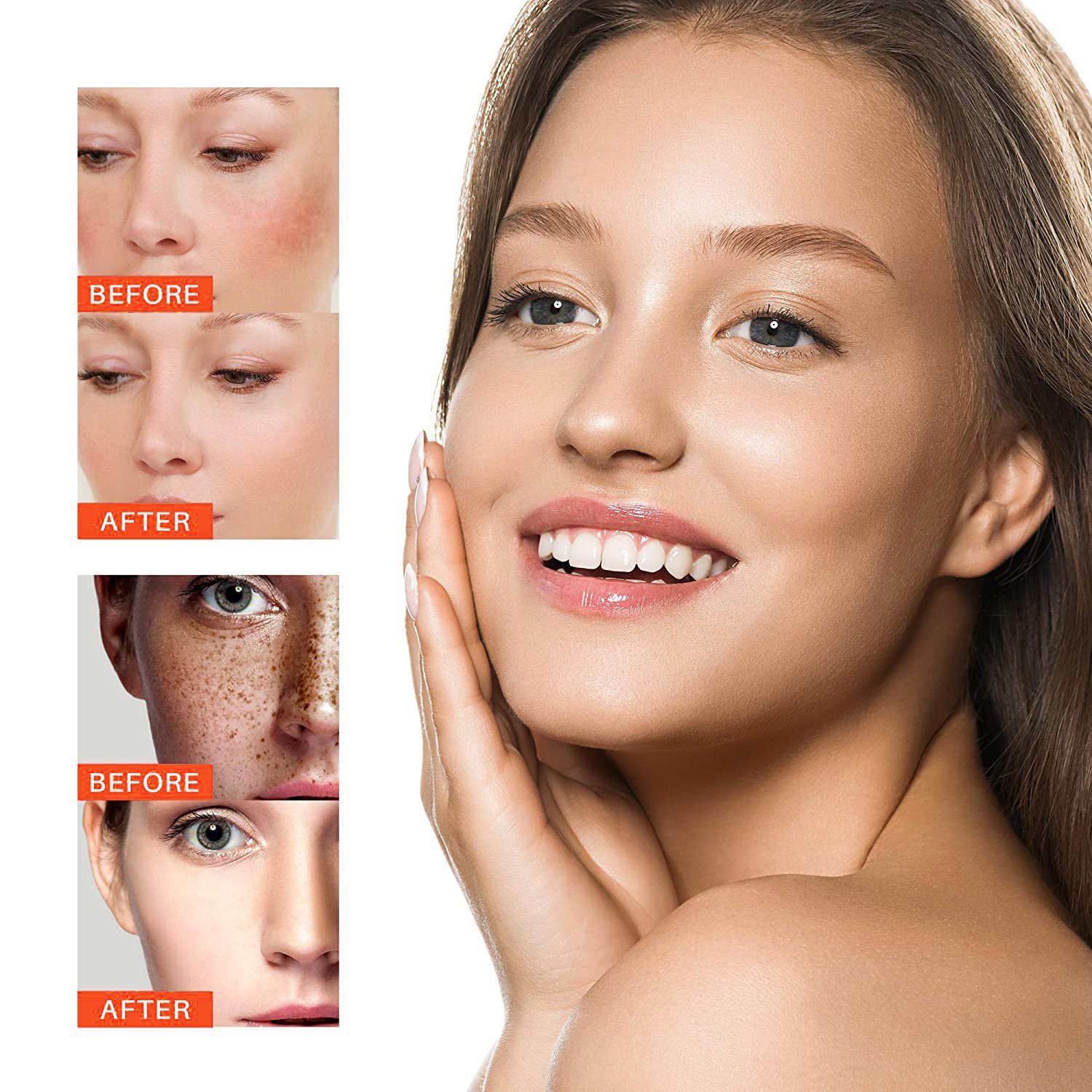 OEM Private Label Whitening Freckle Cream 50g Remove Melasma Dark Spots Brightening Skin Arbutin Niacinamide Lighten Face Cream