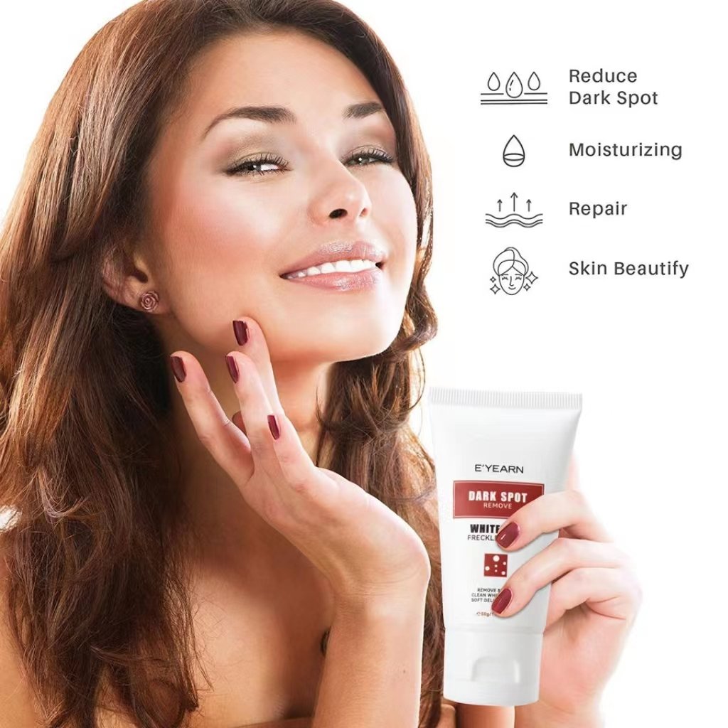 OEM Private Label Whitening Freckle Cream 50g Remove Melasma Dark Spots Brightening Skin Arbutin Niacinamide Lighten Face Cream