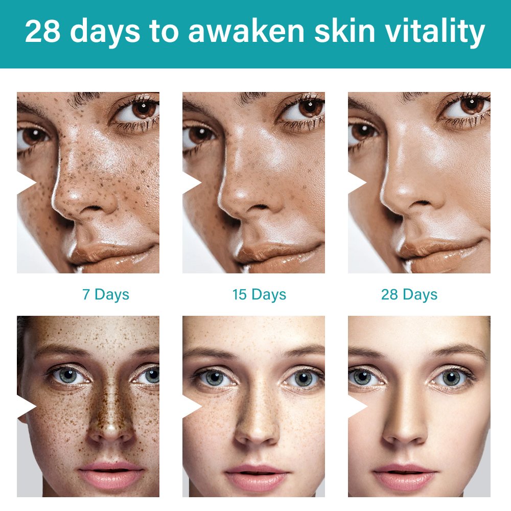 Private Label Strong Effective Whitening Freckle Cream Removal Melasma Dark Spot Melanin Remover Brighten Skin Face Cream