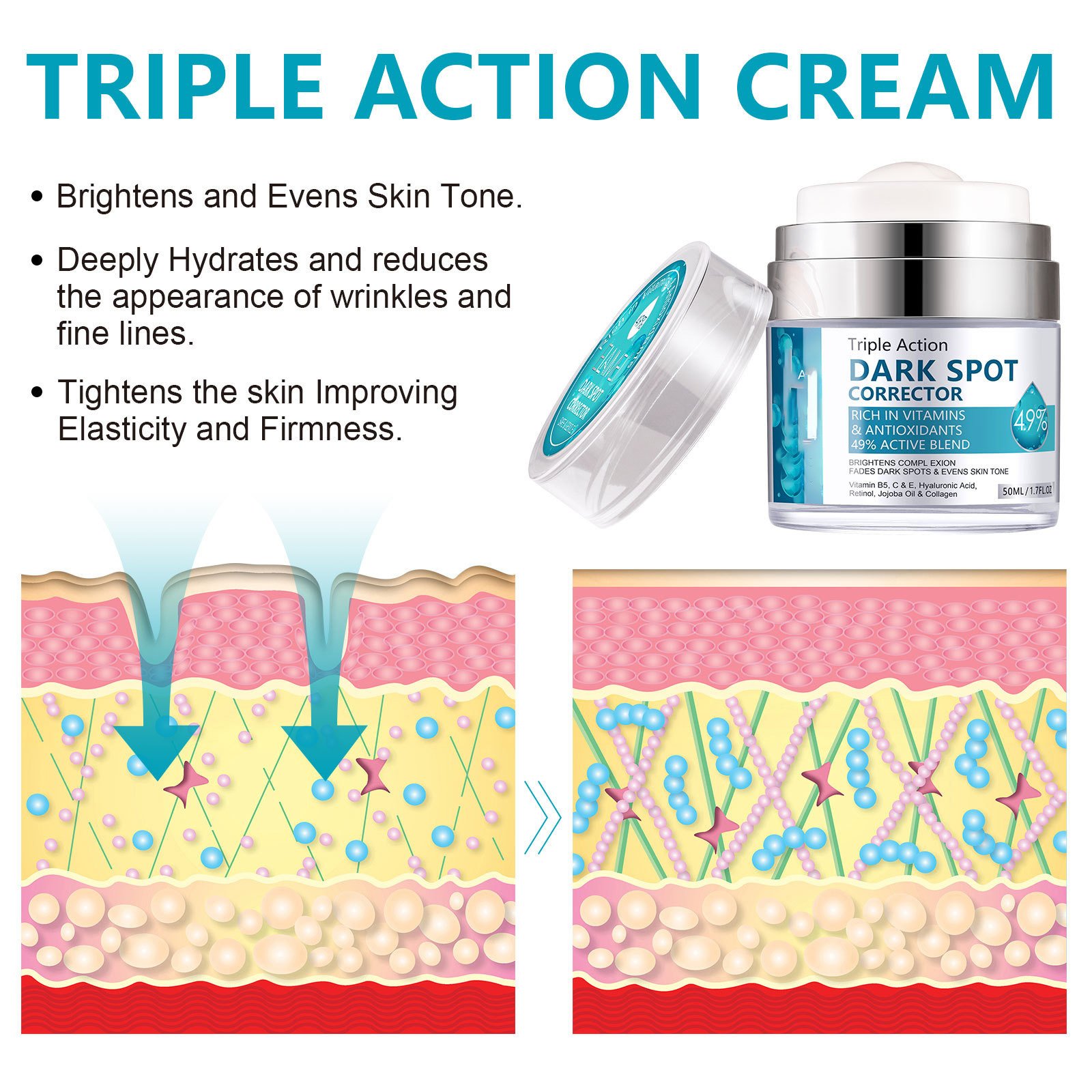 Private Label Removing Whitening Freckle Face Cream Skin Care Dark Spot Corrector Remover Whitening Anti Freckle Cream