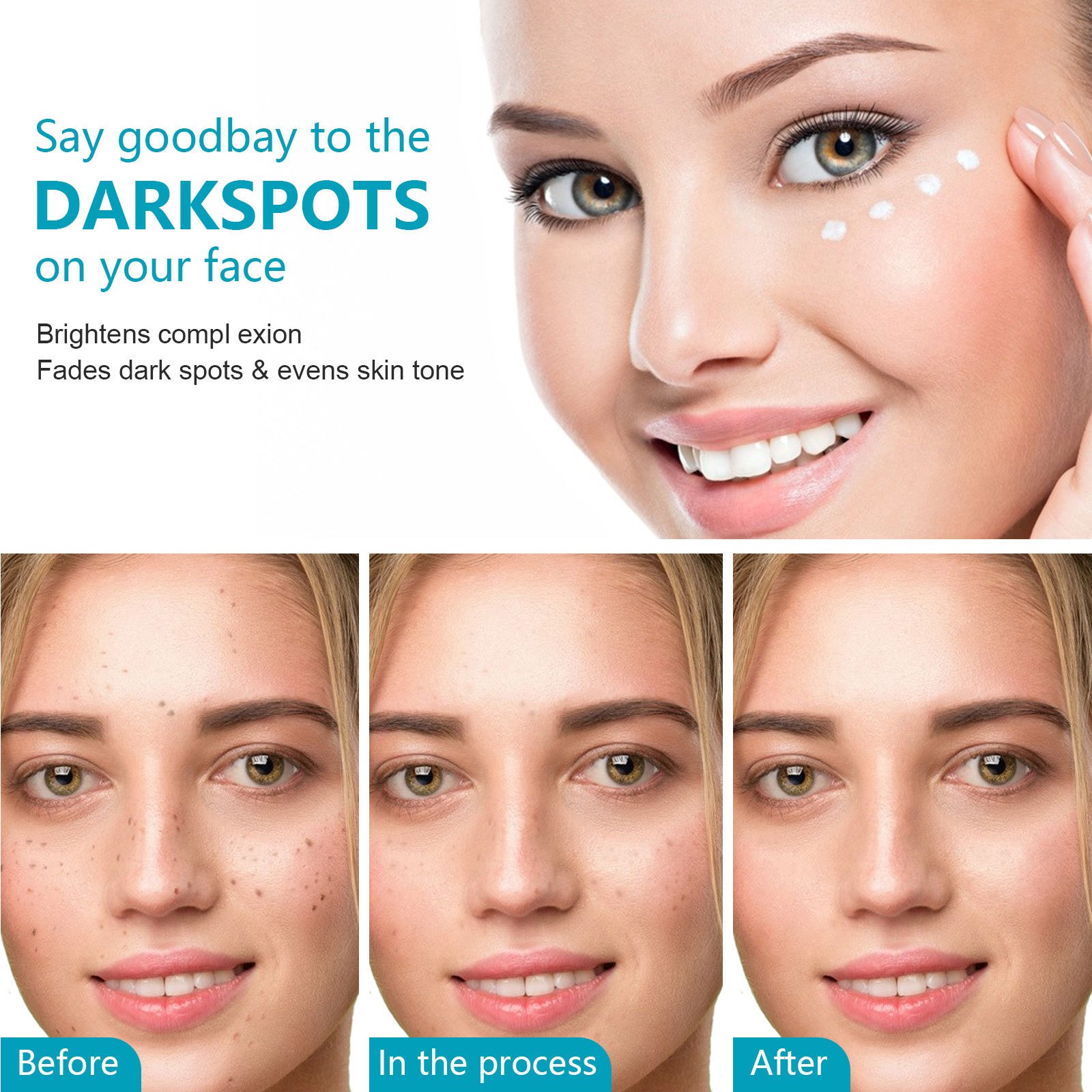 Private Label Removing Whitening Freckle Face Cream Skin Care Dark Spot Corrector Remover Whitening Anti Freckle Cream