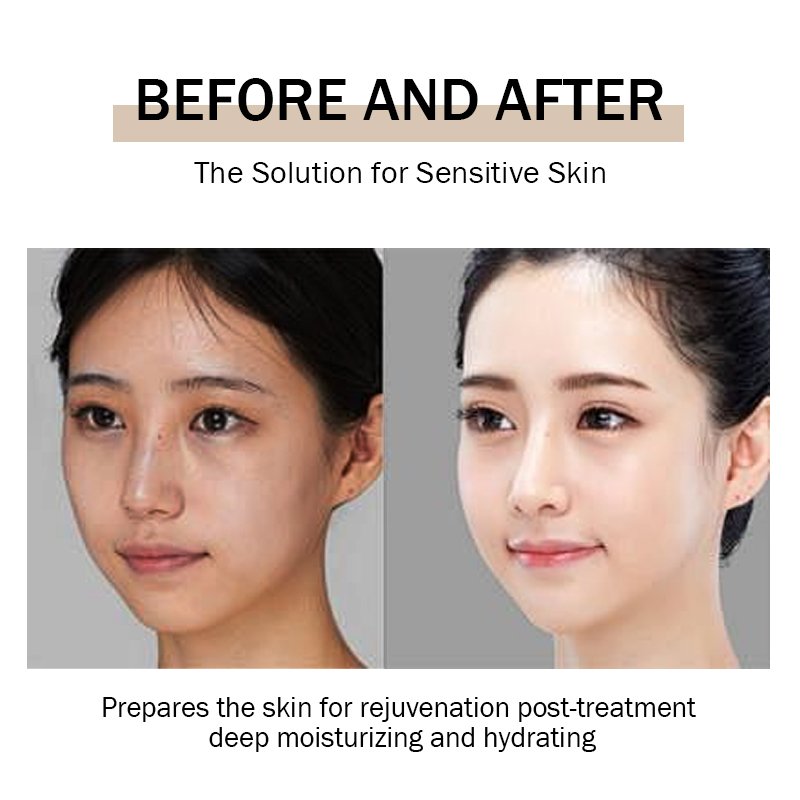 Korean Face Cream Collagen Turmeric Aloe Vera Niacinamide Shea Butter Salicylic Acid Cream for pimples pimple remover