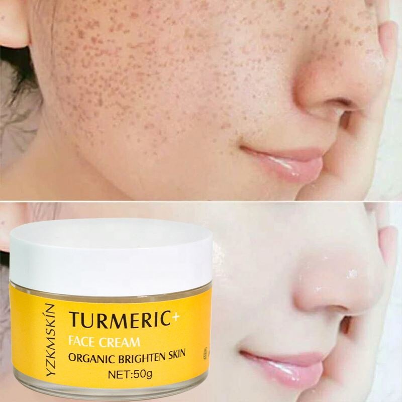 oem odm private label moisturizing antiaging brightening anti acne fades scars dark spots removing turmeric face cream