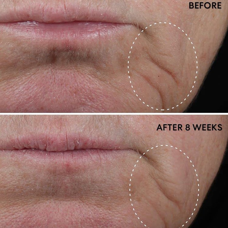 OEM Customized Face Organic Vitamin C Anti-Wrinkle Cream Wholesale Moisturizing Brightening Retinol Face Cream