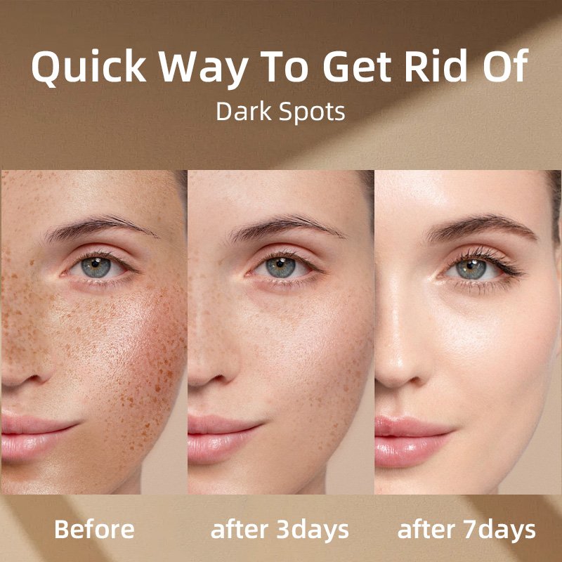 Dark Spot Removing Skin Lightening Bleaching Brightening Whitening Face Cream for Women