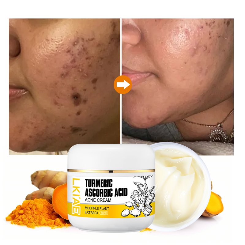Private Label Anti Aging Turmeric Cream Skin Care Moisturizing Whitening Dark Spot Removal Brightening Face Cream for Women