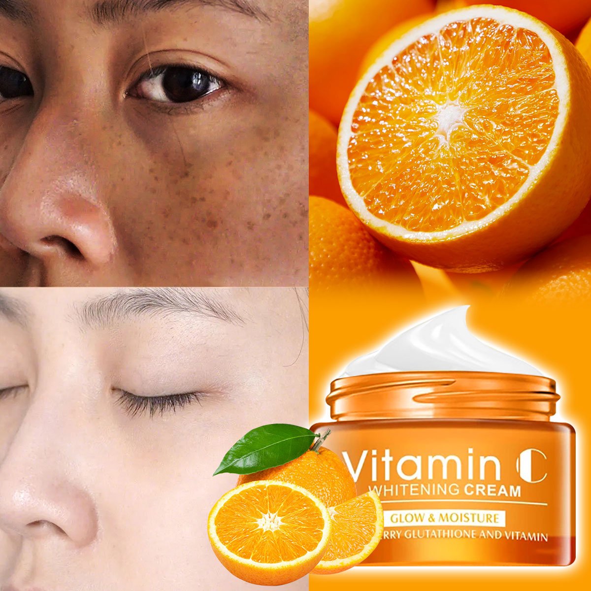 Hot Sale Facial Whitening Remove Dark Spots Anti Freckles Brightening Skin Vitamin C Face Cream
