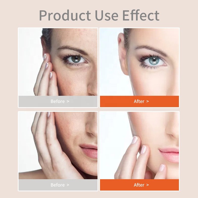 Dark Spot Corrector Remover Anti Aging Pigmentation Skin Care Brightening Whitening Lightening Moisturizer Turmeric Face Cream