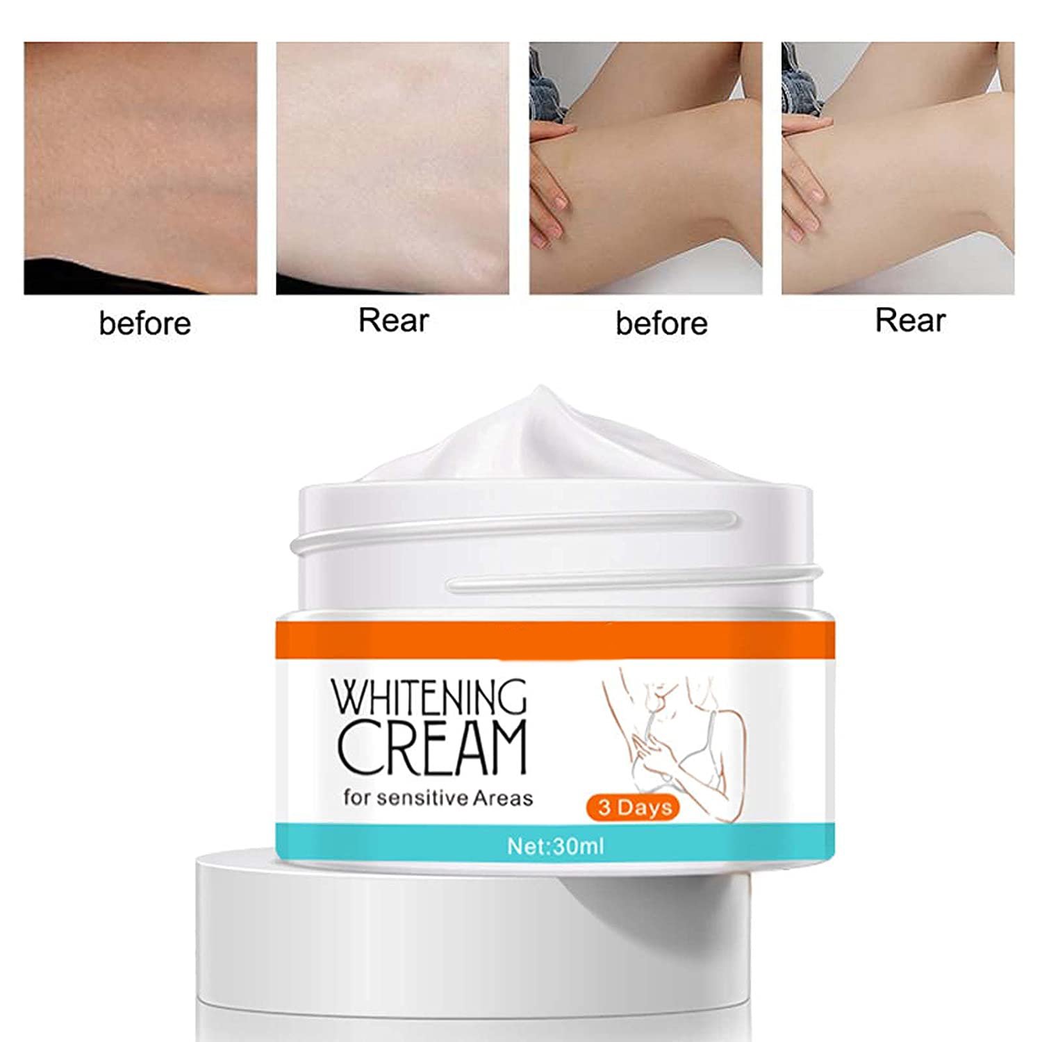 wholesale whitening face and body cream Dark Spot Remove Cream Underarms Brightening Cream Knees Elbows Dark Spot