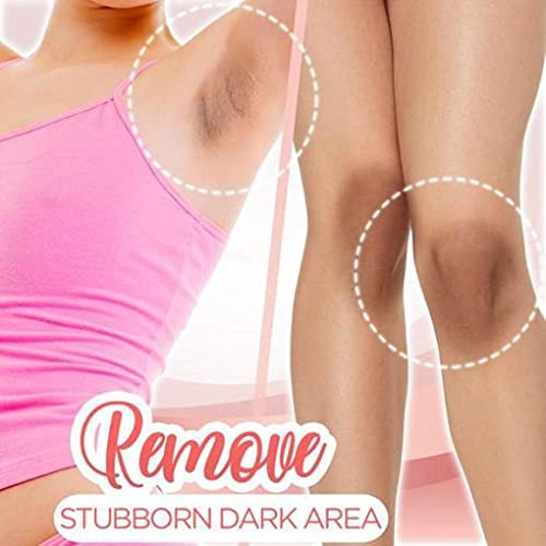 wholesale whitening face and body cream Dark Spot Remove Cream Underarms Brightening Cream Knees Elbows Dark Spot
