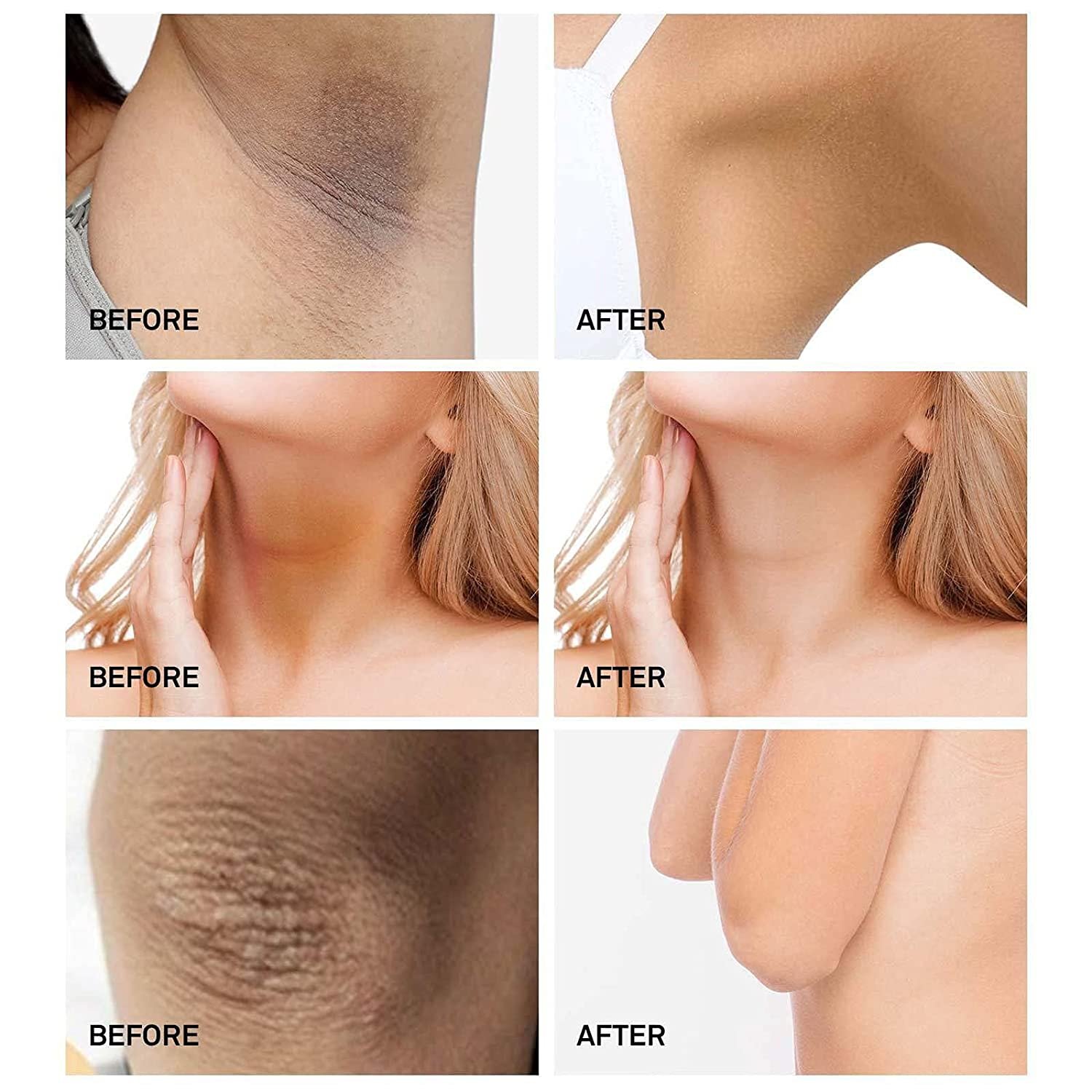 wholesale whitening face and body cream Dark Spot Remove Cream Underarms Brightening Cream Knees Elbows Dark Spot
