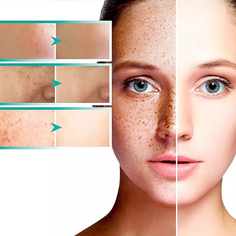 wholesale whitening face and body cream Dark Spot Remove Cream Underarms Brightening Cream Knees Elbows Dark Spot