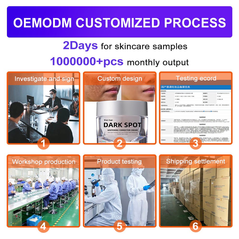 Best freckle removal whitening moisturizing cream repairing black skin to remove dark spots face lotion for glowing skin