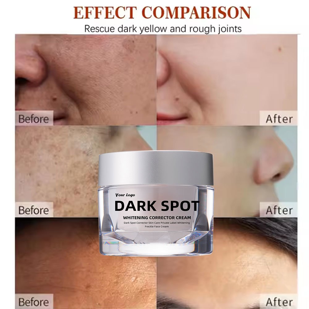 Best freckle removal whitening moisturizing cream repairing black skin to remove dark spots face lotion for glowing skin