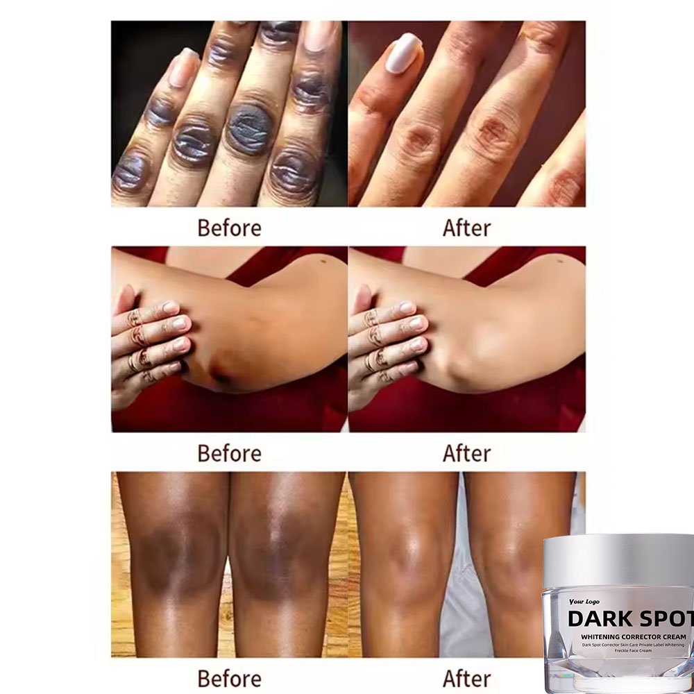 Best freckle removal whitening moisturizing cream repairing black skin to remove dark spots face lotion for glowing skin