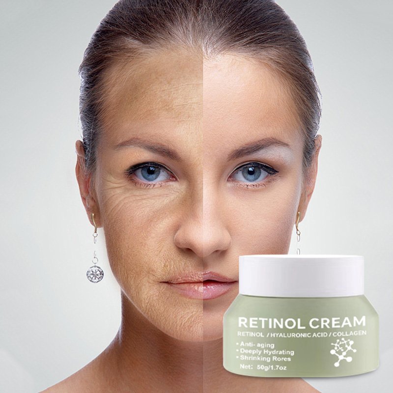OEM Retinol Cream Reduces Wrinkles Moisturizing Anti Aging Cream Freckle Removal Face Cream