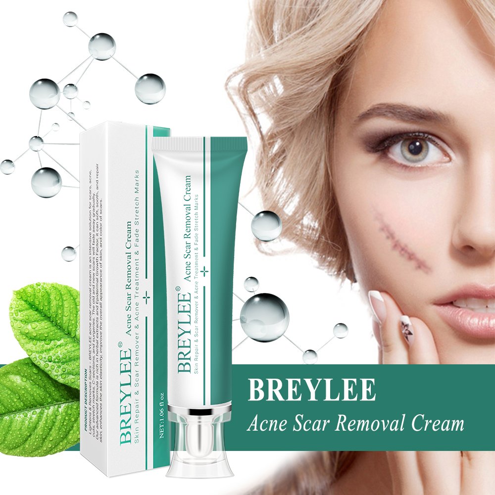 BREYLEE Acne Scar Removal cream Treatment cream