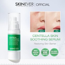 20ml