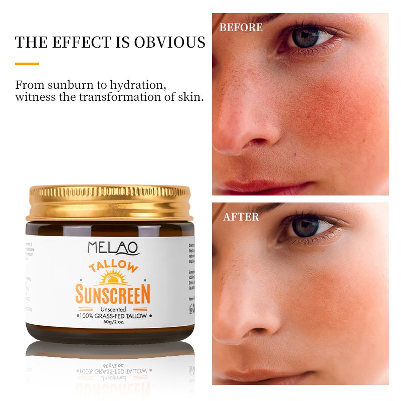 High Quality Face for Skin: Premium Honey Balm Beef Tallow For Skin Moisturizing And Smooth Grass-fed Sun Beef Tallow Balm