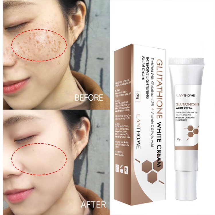 High Quality Melasma Blemish Removal Dark Spot Remover Cream Strong Whitening Face Freckles Remove Face Cream