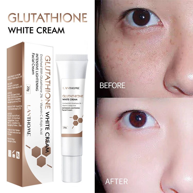 High Quality Melasma Blemish Removal Dark Spot Remover Cream Strong Whitening Face Freckles Remove Face Cream