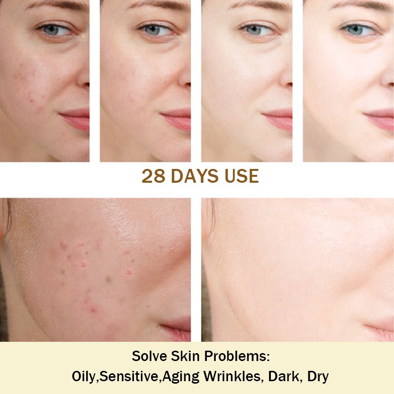 Acne treatment cream Skin Moisturizing & Firming Lifting Peptide Anti-Wrinkle Revitalizing Cream Anti Acne Face Cream