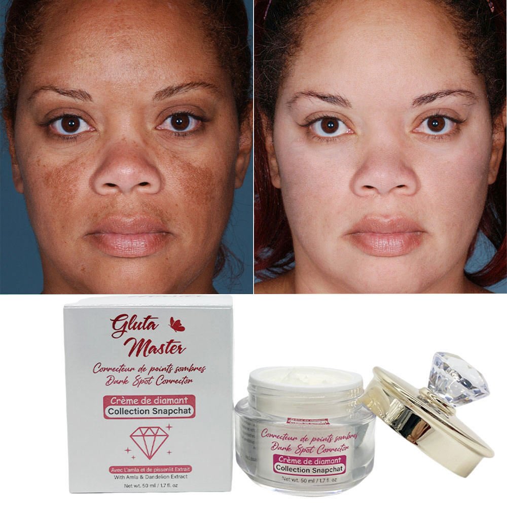Diamond whitening face cream beauty Body Dark Spots Remove Face Cream Brightening Best Cream To Lighten The Skin Of The Face