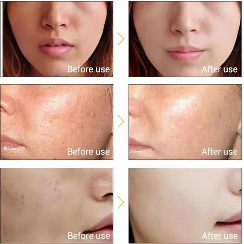 OEM Vitamin C Koji Acid Double Glutathione Essence Lighting Dark Spots Remover Freckle Brighten Hydrating Skin Care Face Serum