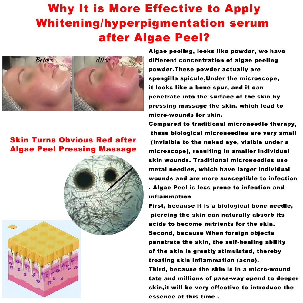 Dark Spots Correcting Remover Serum Hyperpigmentation Skin Pigmentation Concentration After skin Peel Microneedling Treatment