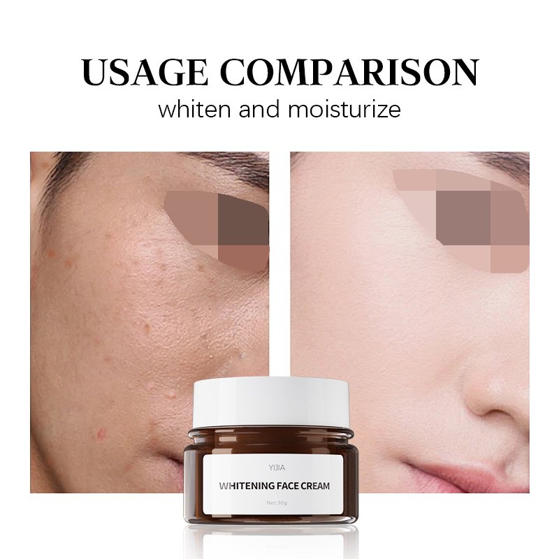 Factory Directly Supply Face Care Products Whitening Dark Spot Remover Dunkle Flecken aufhellende Gesichtscreme Face Cream