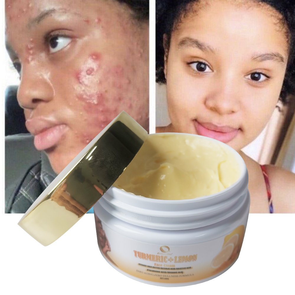 High quality natural black spot removing cream anti aging vitamin C skin care whitening turmeric moisturizing face cream