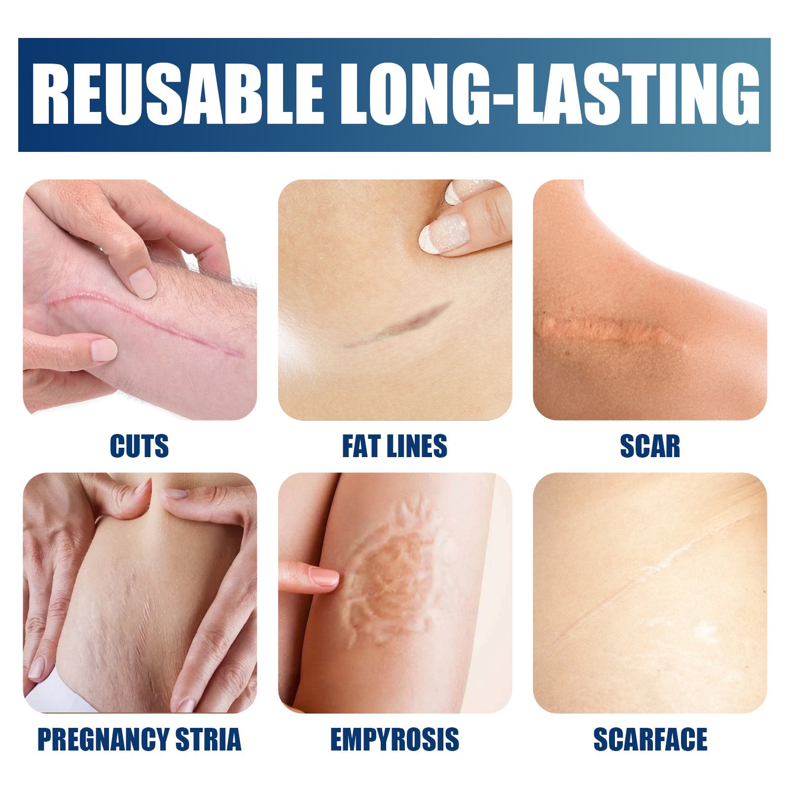Hot Skin Repair Fade Scars Silicone Scar Gel 30g Stretch Mark Surgery Scar Repair cream