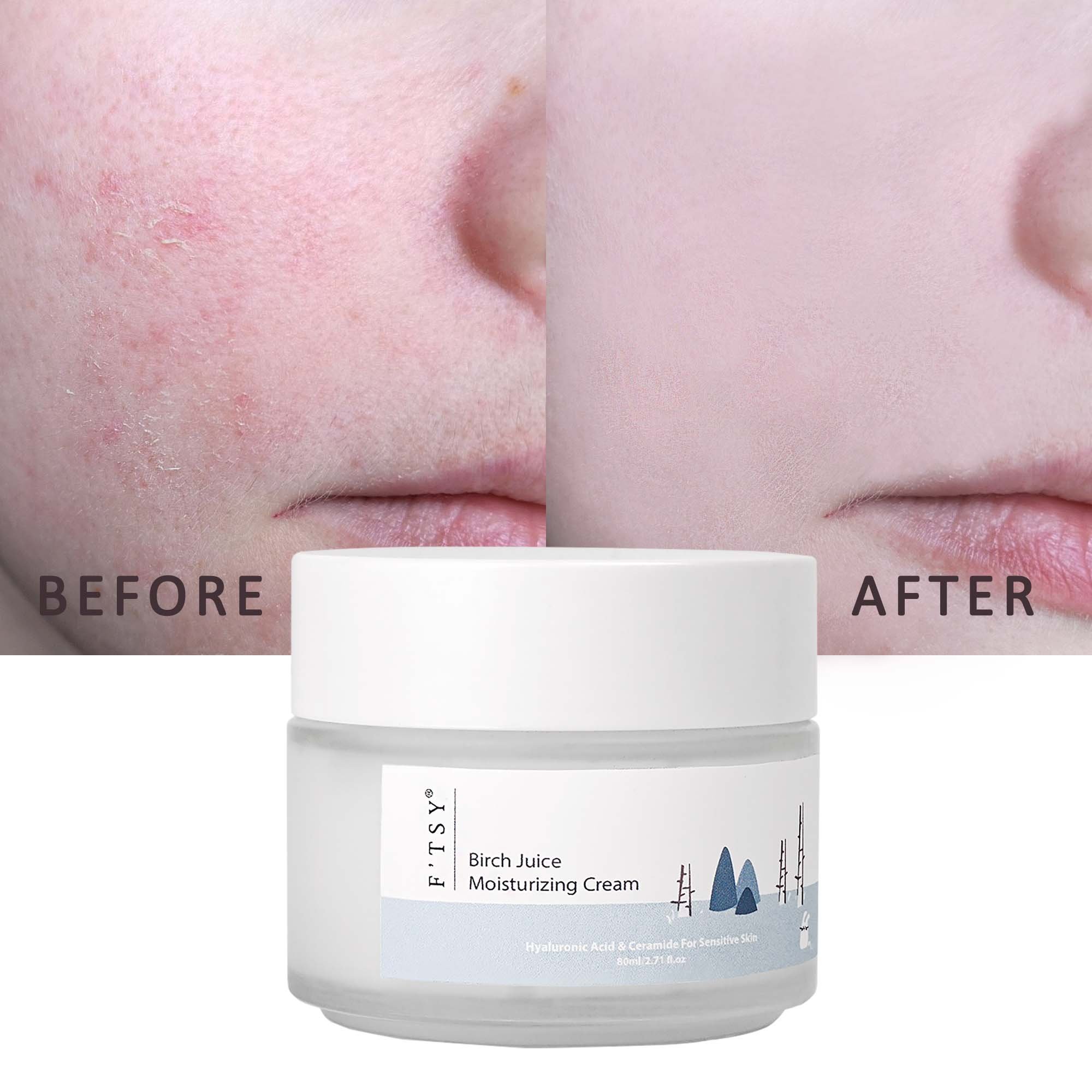Birch Juice Hydrating Moisturizing Facial Cream Custom Korean Day And Night Ceramide Face Moisturizer Face Cream