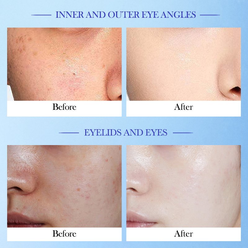 High moisturizing vitamin E milk firming repairing anti-oxidation and skin beautifying face cream