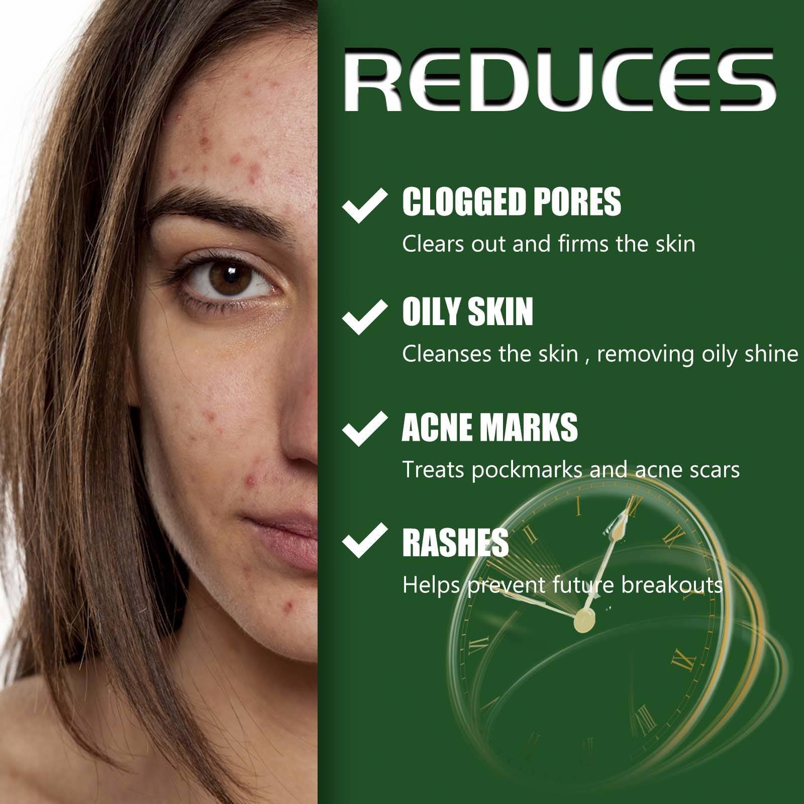 South Moon Collagen Vitamin Moisturizing Anti Aging Acne And Pimple Dark Spot Removal Whitening Corrector Face Cream For Face