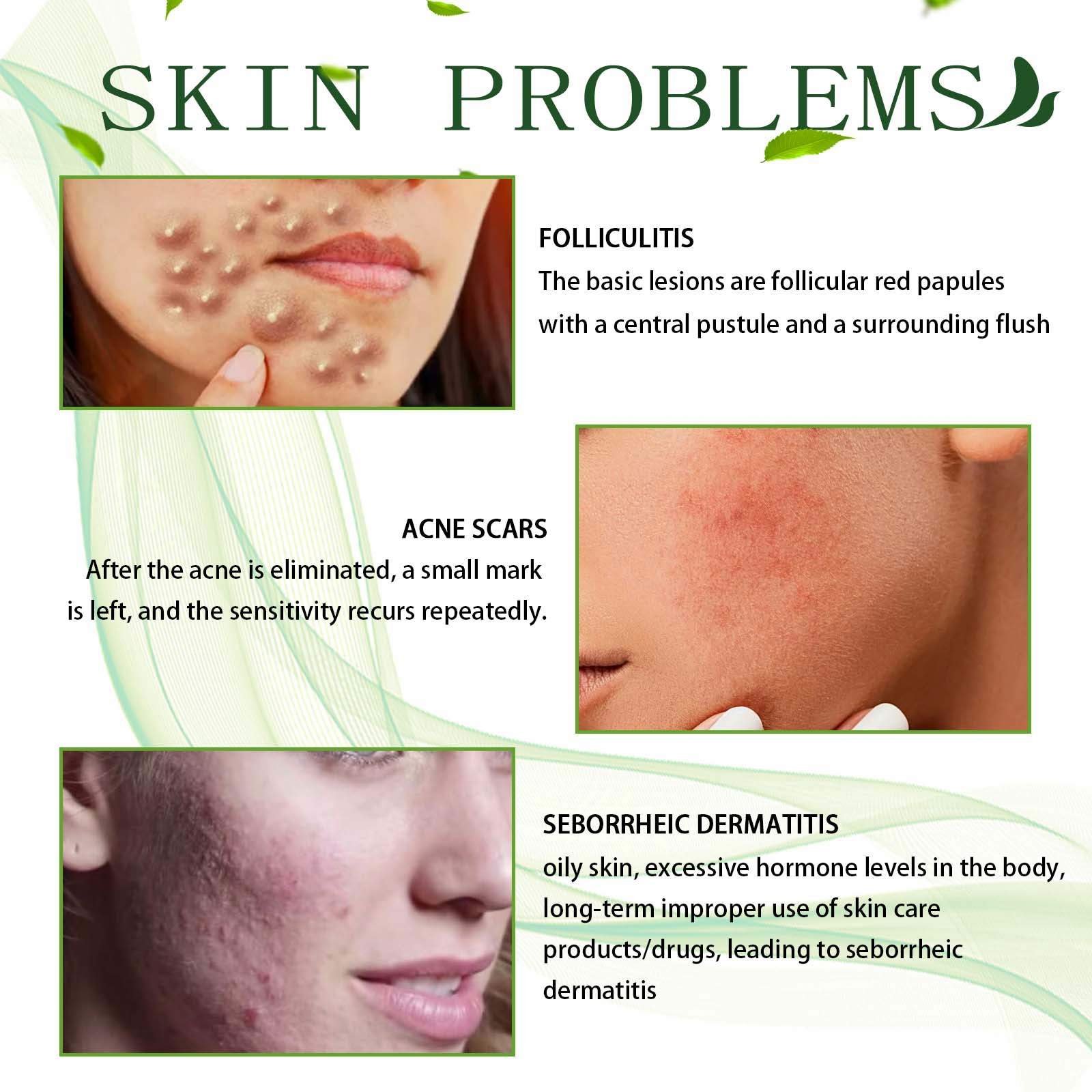 South Moon Collagen Vitamin Moisturizing Anti Aging Acne And Pimple Dark Spot Removal Whitening Corrector Face Cream For Face