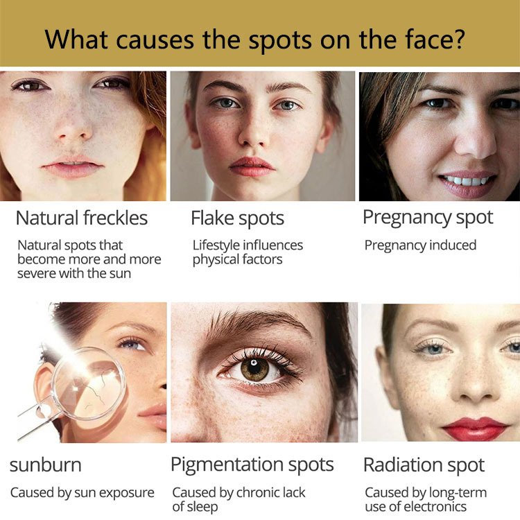 Best Face Cream for Pimple Cruelty-Free Moisturizer Whitening and Natural Hyaluronic acid Snail Face Cream